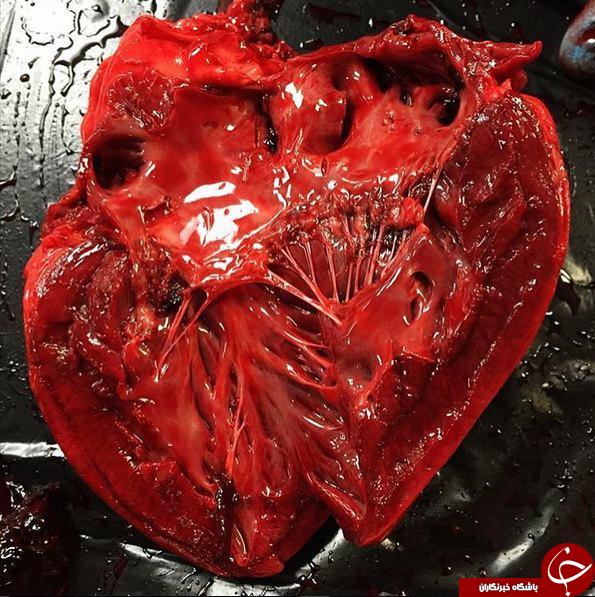 قلب بعد از مردن چه شکلی است؟+ تصاویر