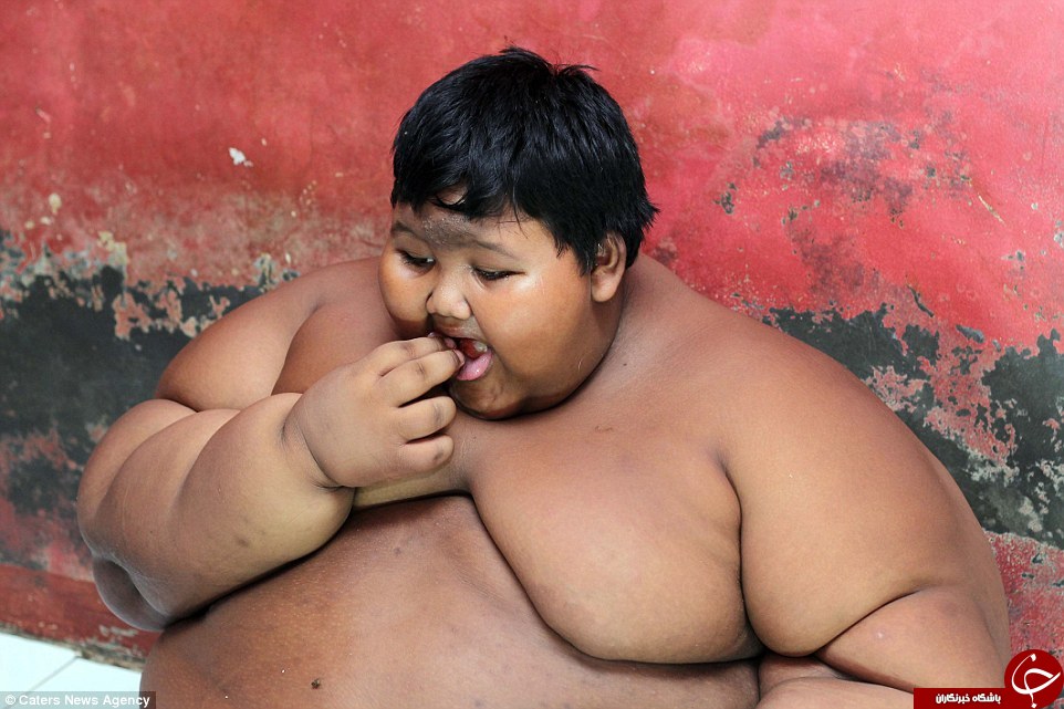 چاق‌ترین پسر دنیا می‌خواهد رژیم بگیرد+تصاویر